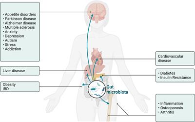 Advancing our understanding of the influence of drug induced changes in the gut microbiome on bone health